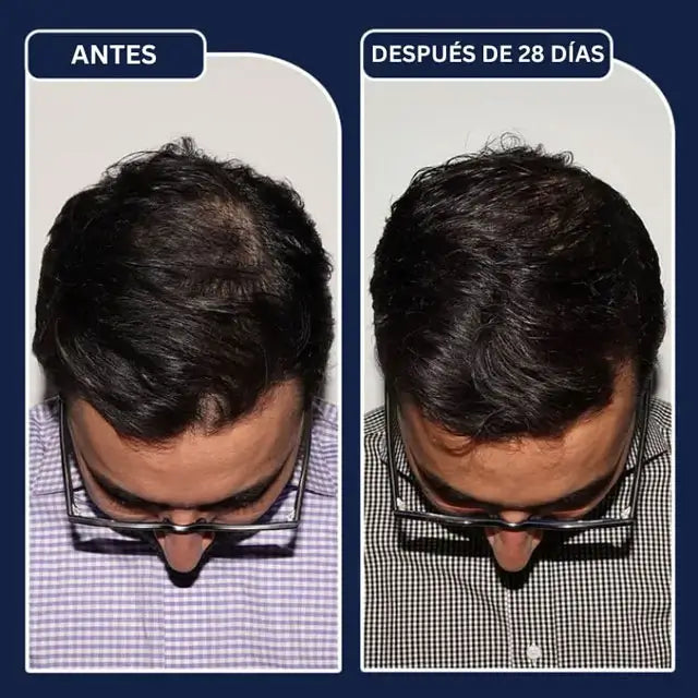 FEG Spray Anticaída - Crece 4x Más Rápido en 4 Semanas