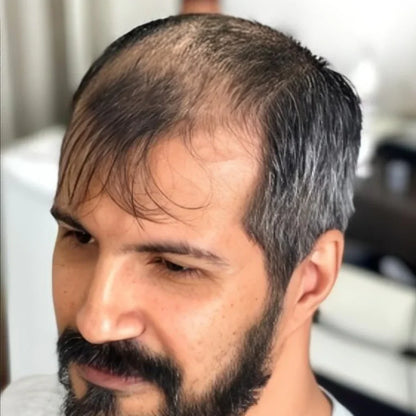 Spray para el crecimiento del cabello FEG