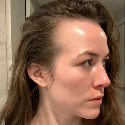 Spray para el crecimiento del cabello FEG