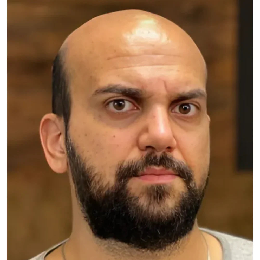 Spray para el crecimiento del cabello FEG